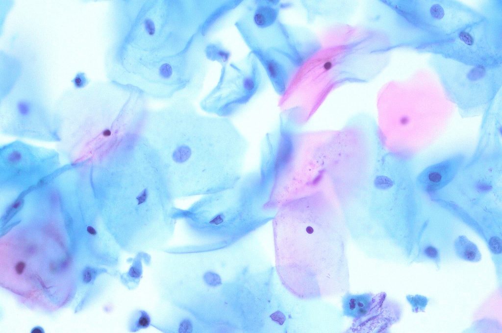 MyPathologyReport ca Pathology For Patients 