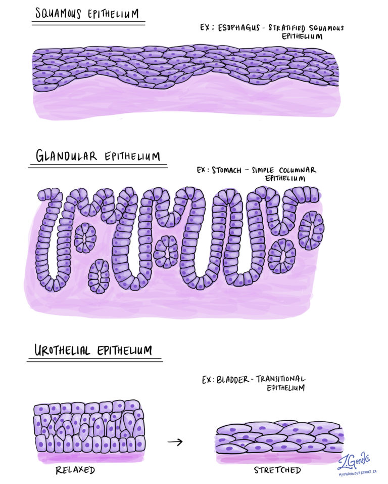 What does epithelium mean? MyPathologyReport.ca