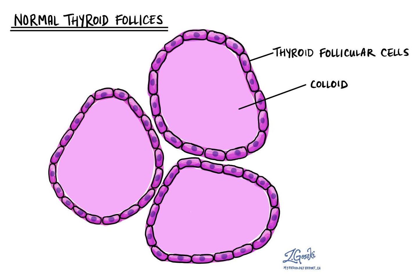 Normal thyroid follicles