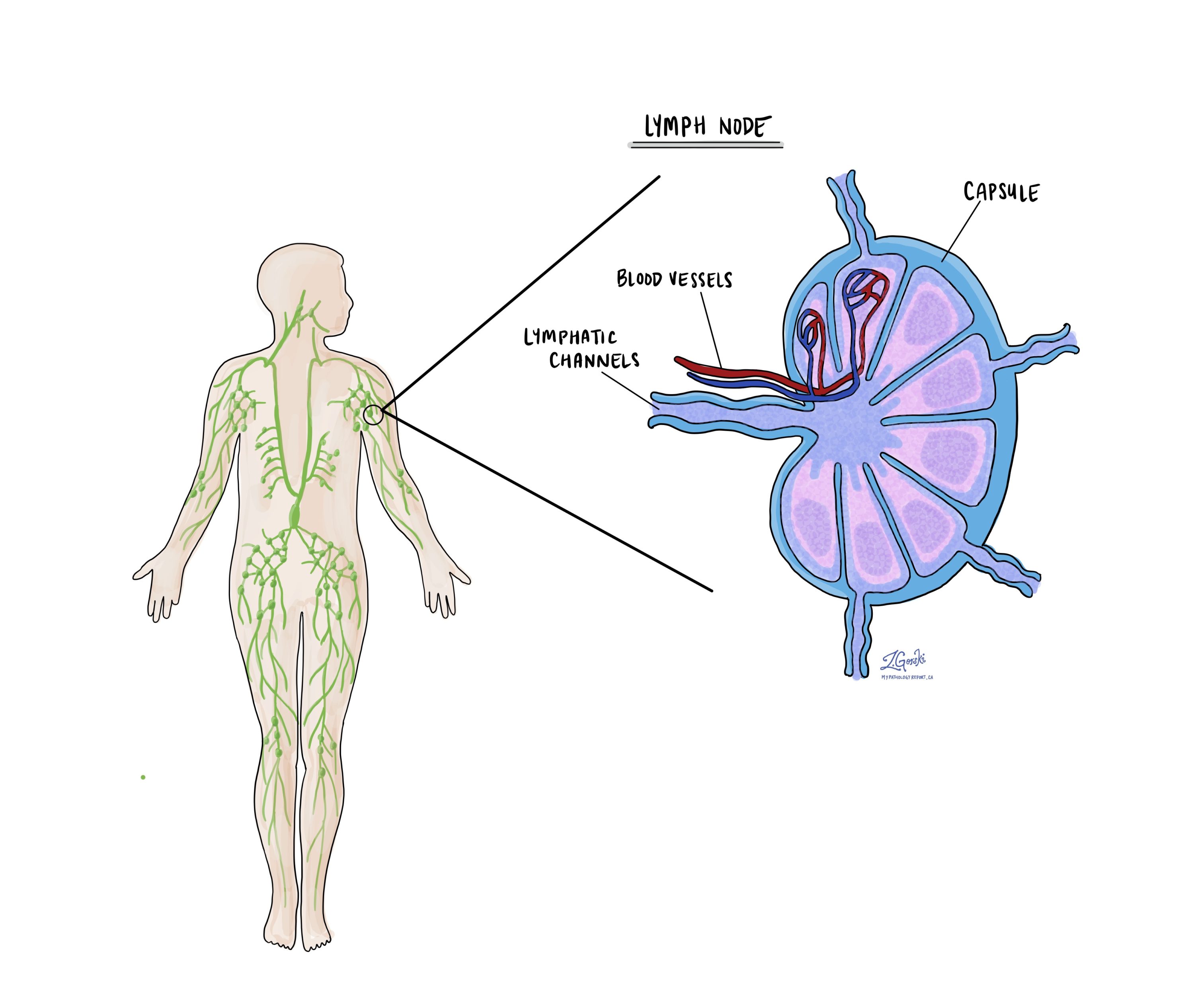 Lymfeknoop