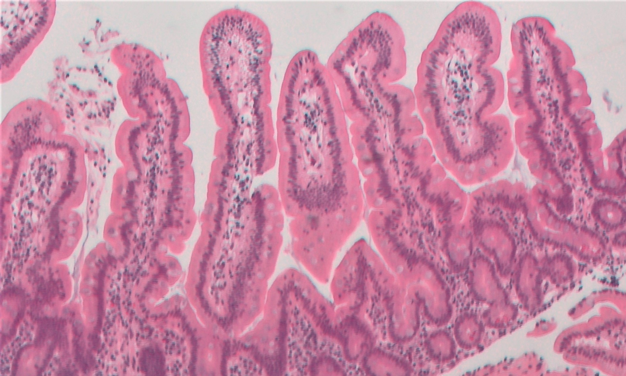 duodenum normal