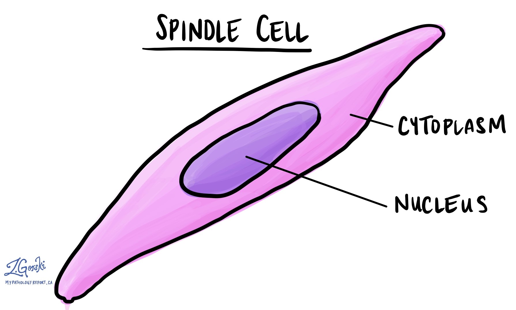 Spindle cell