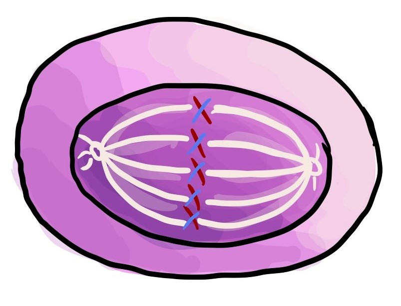 有丝分裂 病理词典 我的病理报告.ca