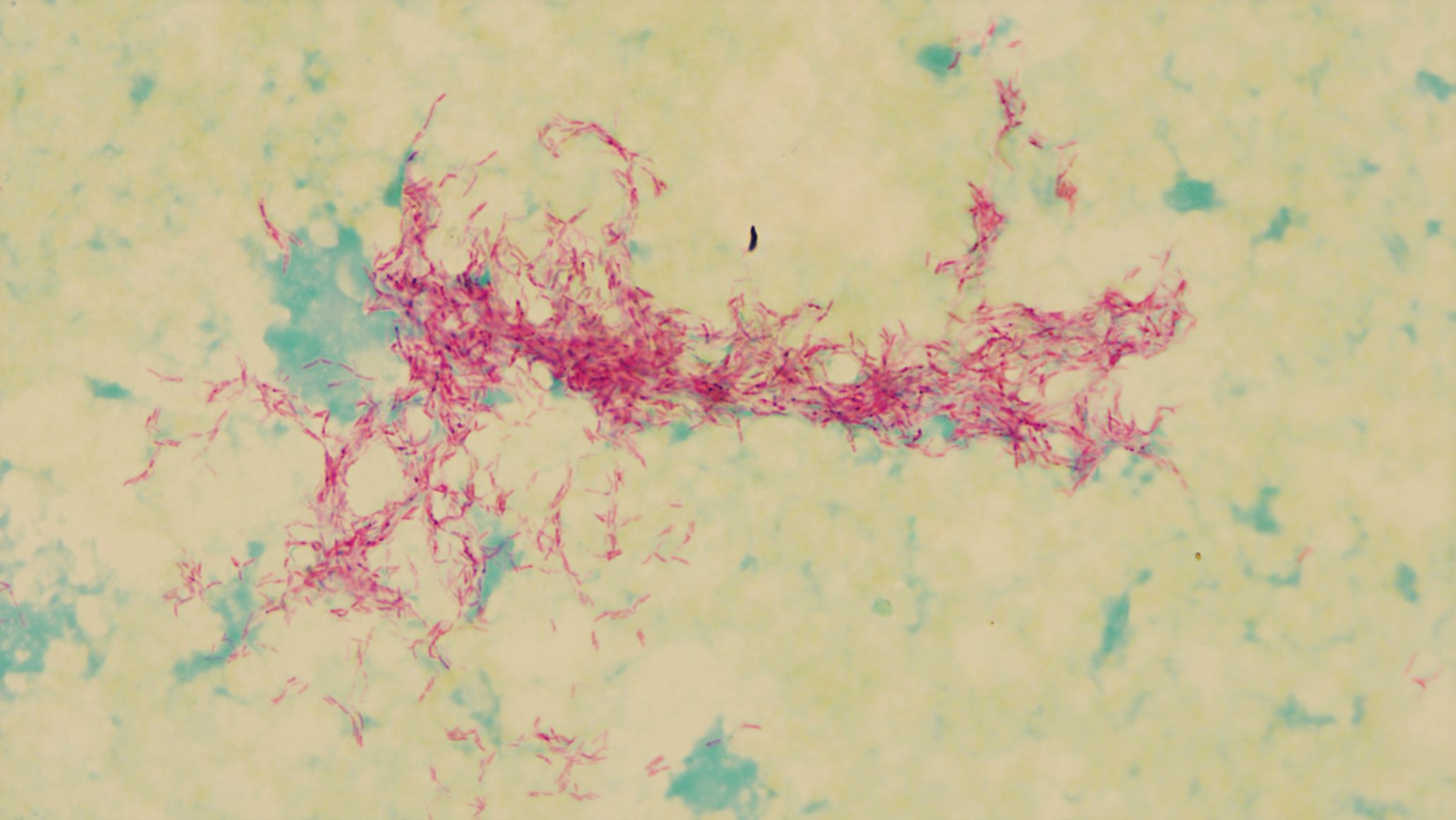 どのように診断されるのでしょうか?