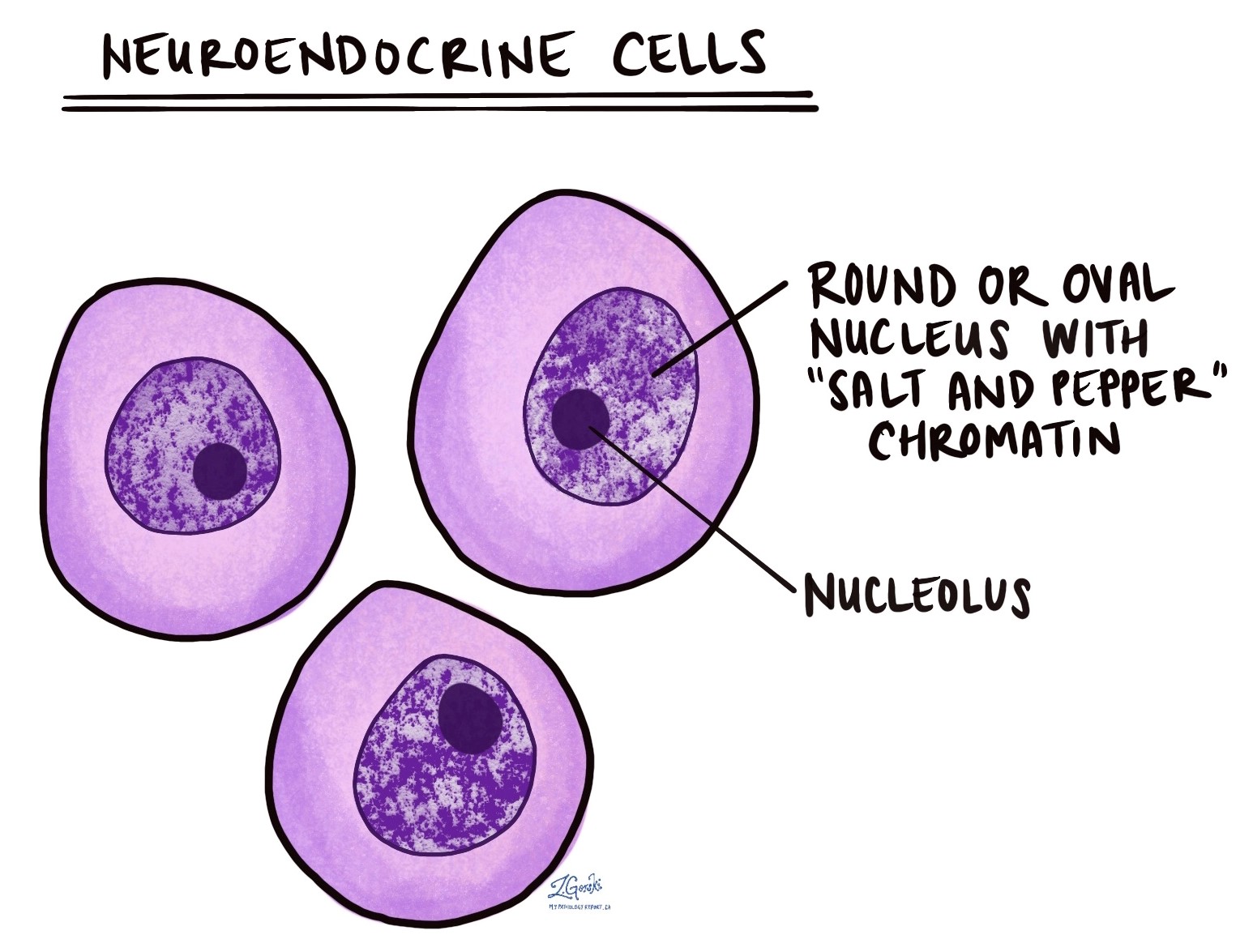 neuroendocrine cells
