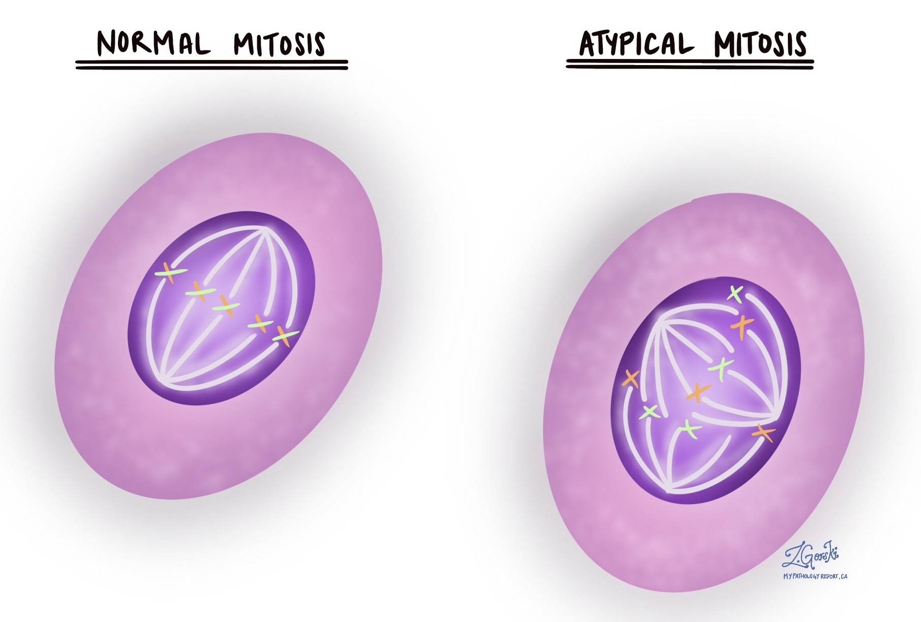 atypical mitosis