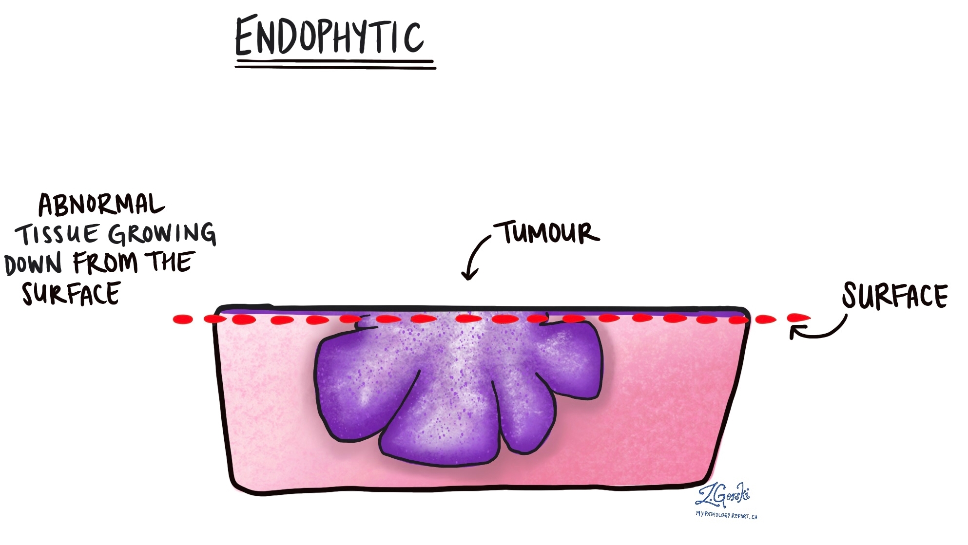 endophytic