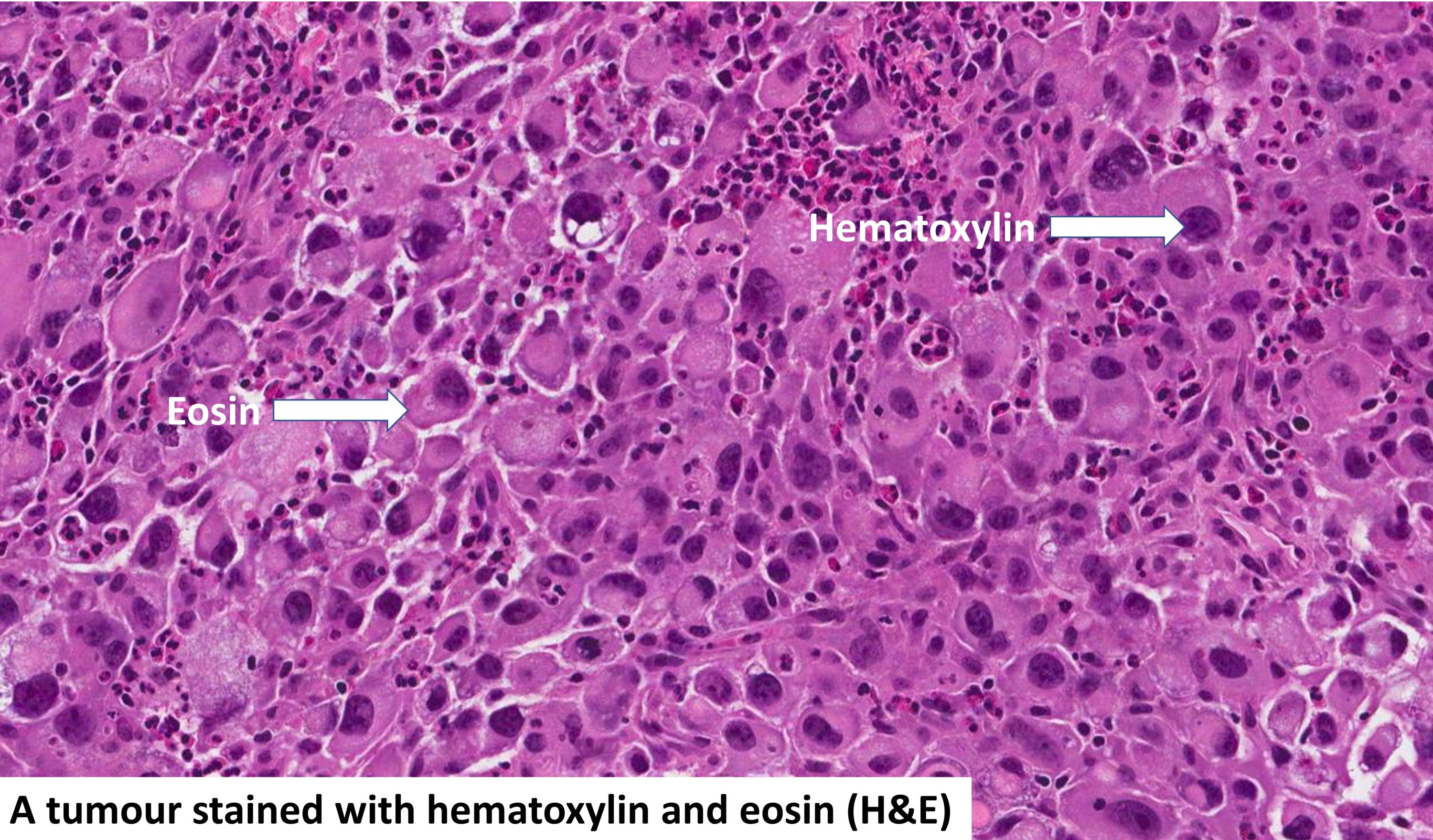 hematoxylin and eosin (H&E)