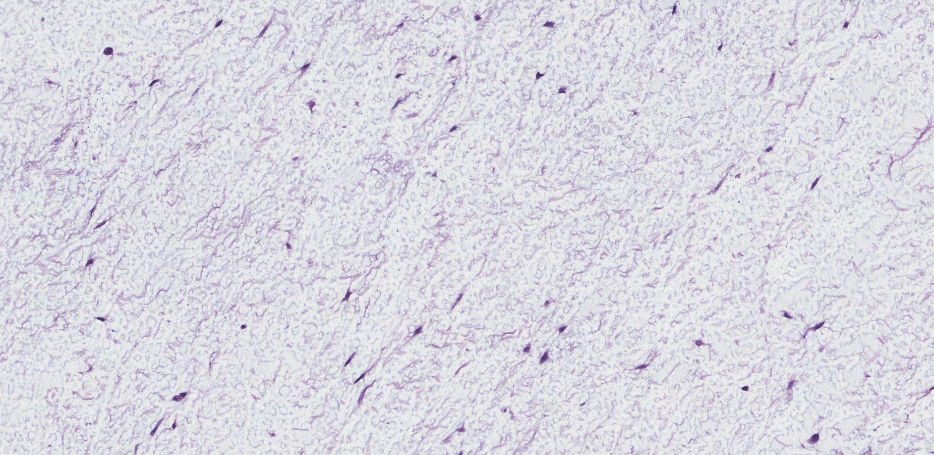 myxoma