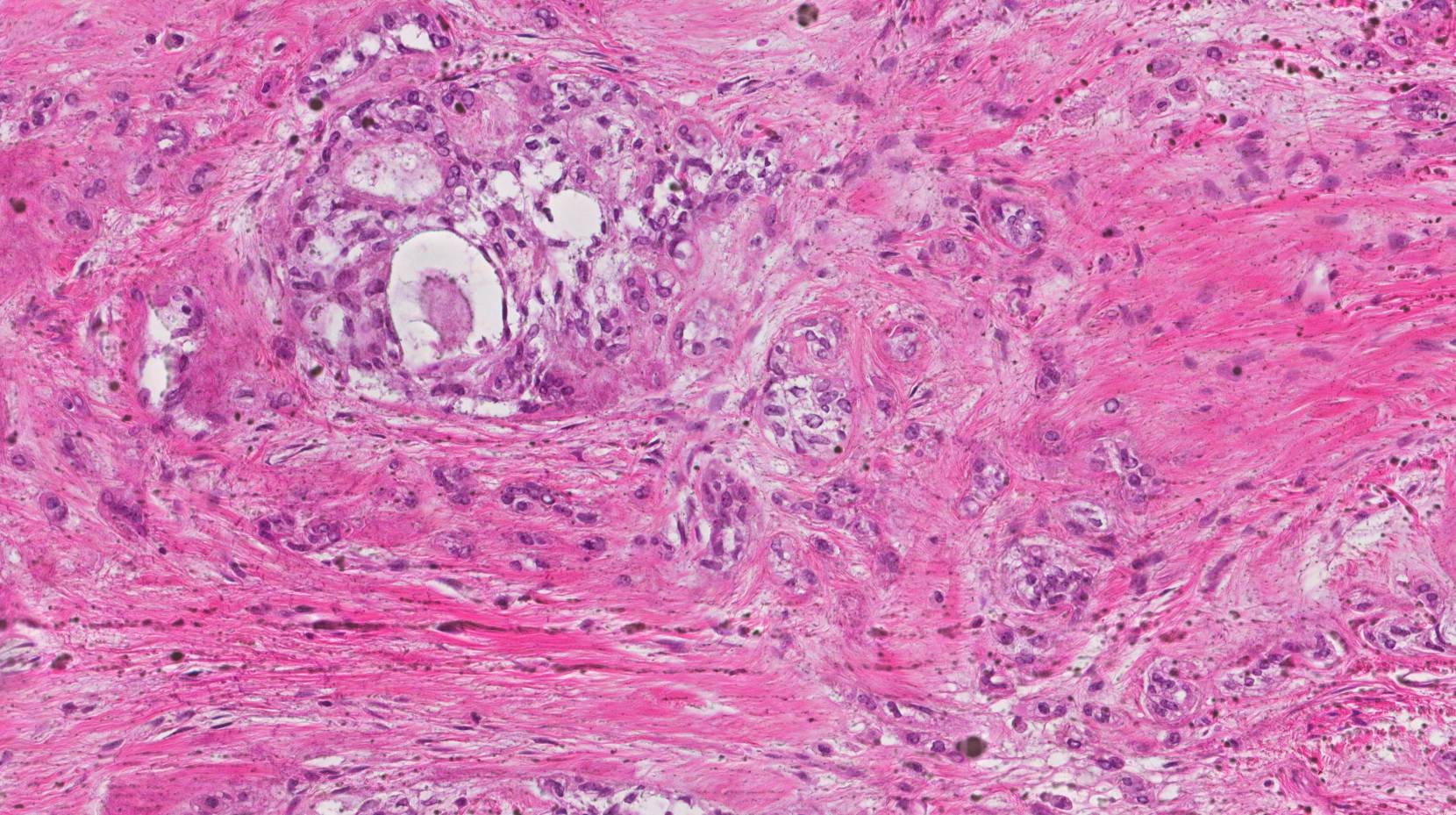 アヒル足の治療法はありますか?