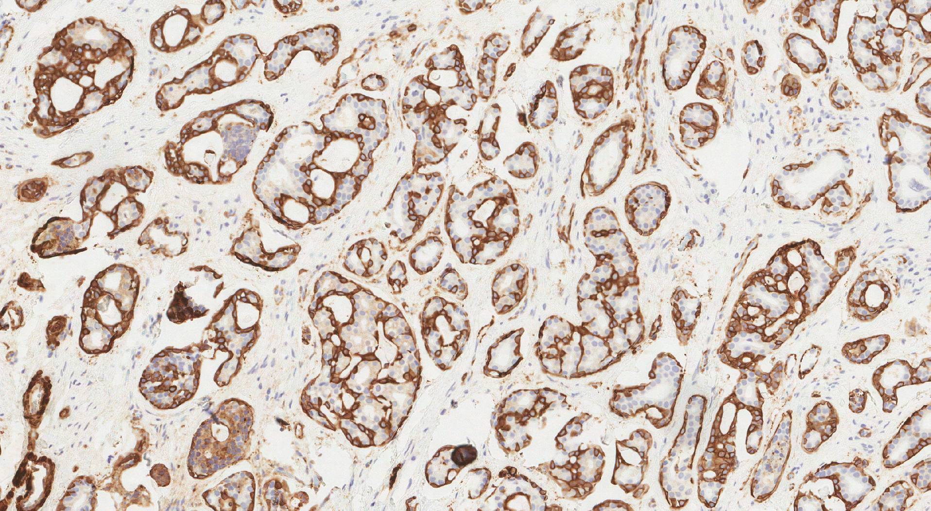 Ezen a képen a simaizom aktin pozitív sejtjei (barna) láthatók az immunhisztokémiával kiemelve.