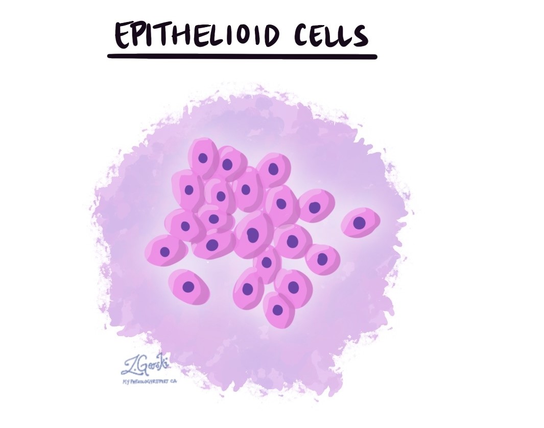 Эпителиоидные клетки