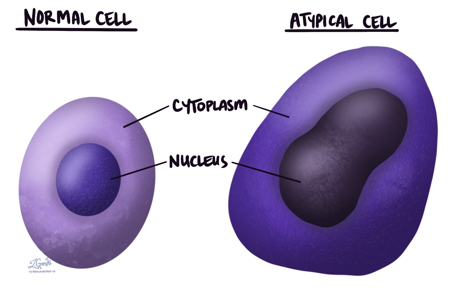 Atypical cell