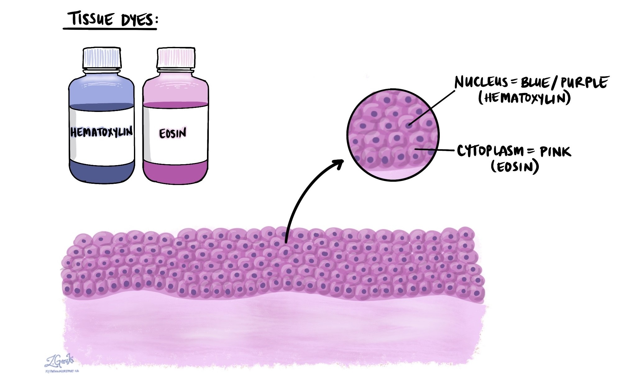 Hematoxylin and eosin (H&E)