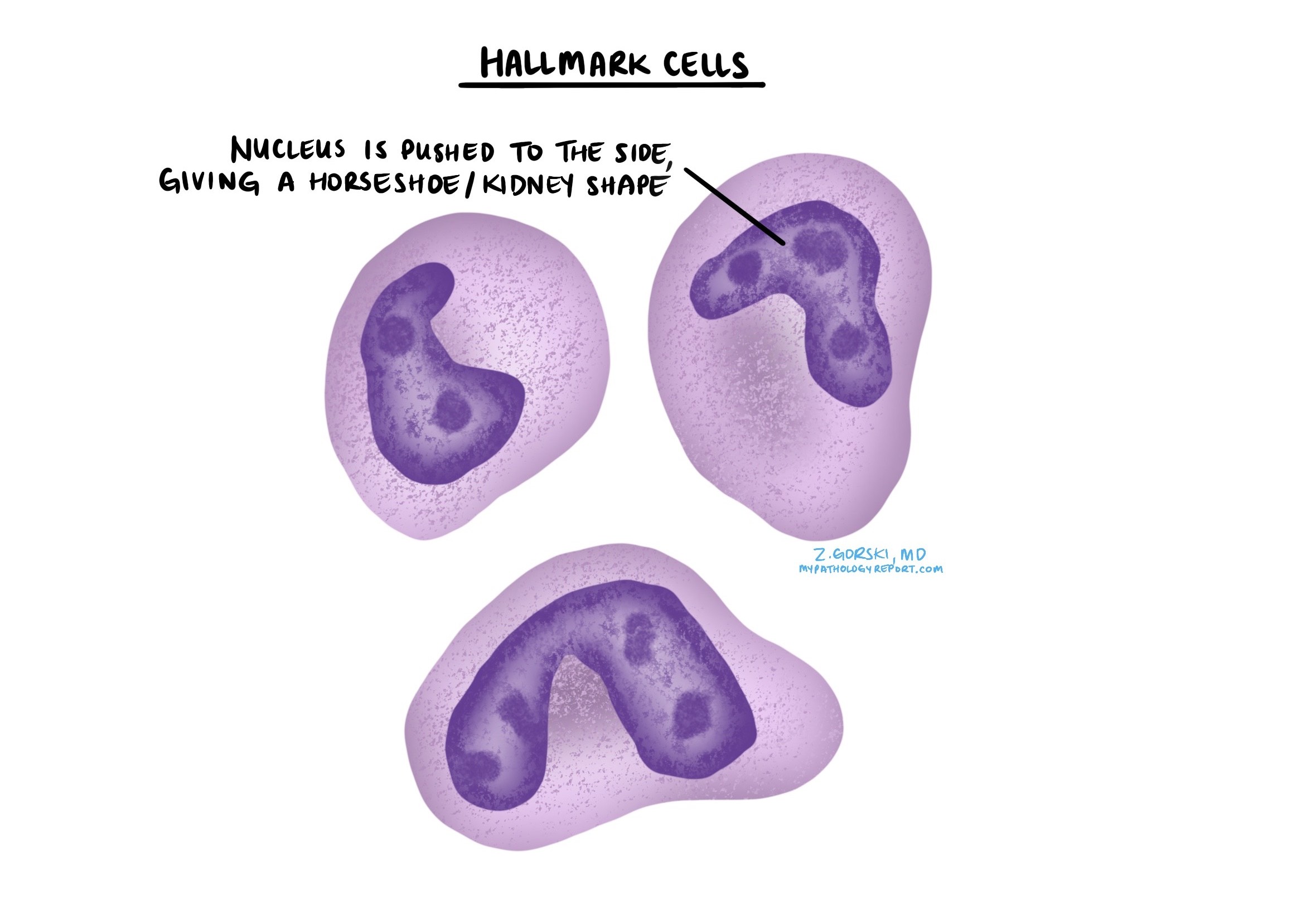 células distintivas