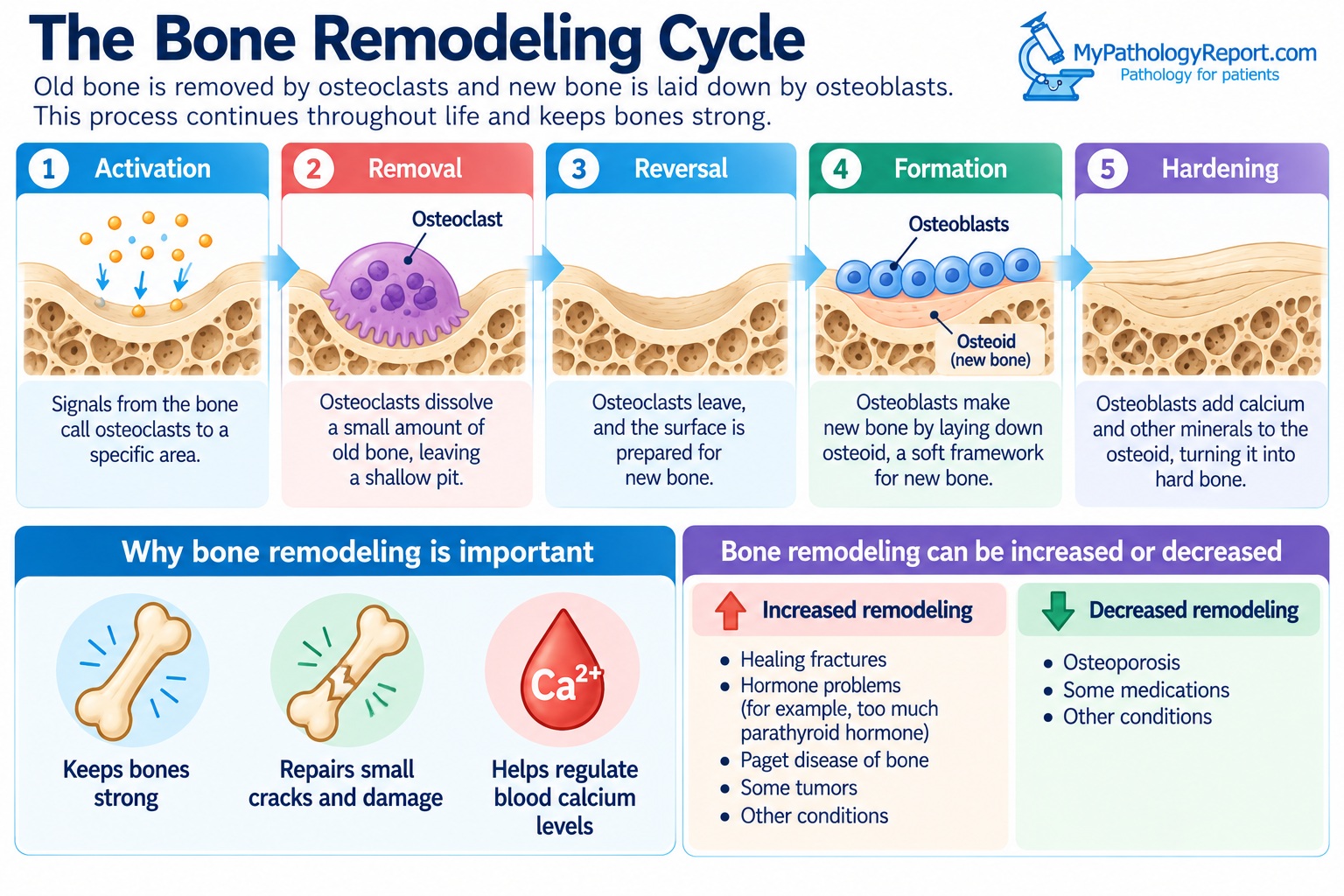 The Bone Remodeling Cycle Infographic
